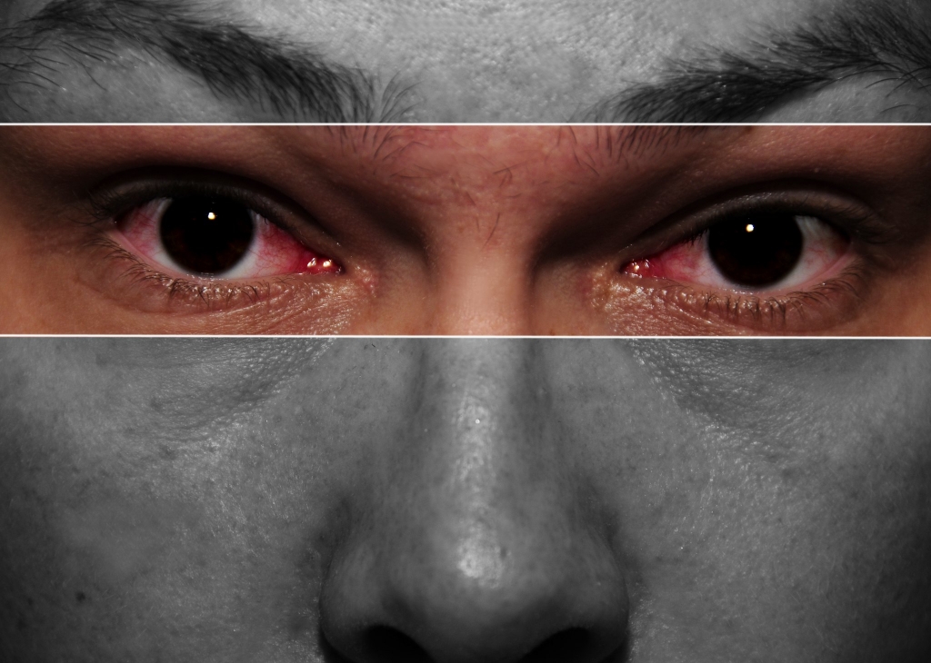 Bloodshot or red eyes could be a sign of high blood pressure - EconoTimes
