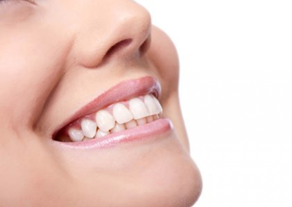 September 2019 IPO Helped SmileDirectClub Become an Industry Pioneer - Vimarsana News