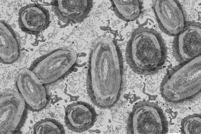 Monkeypox: we have vaccines and drugs to treat it - Vimarsana News